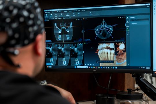 Dental Implants Aid Long-Term Jaw Health